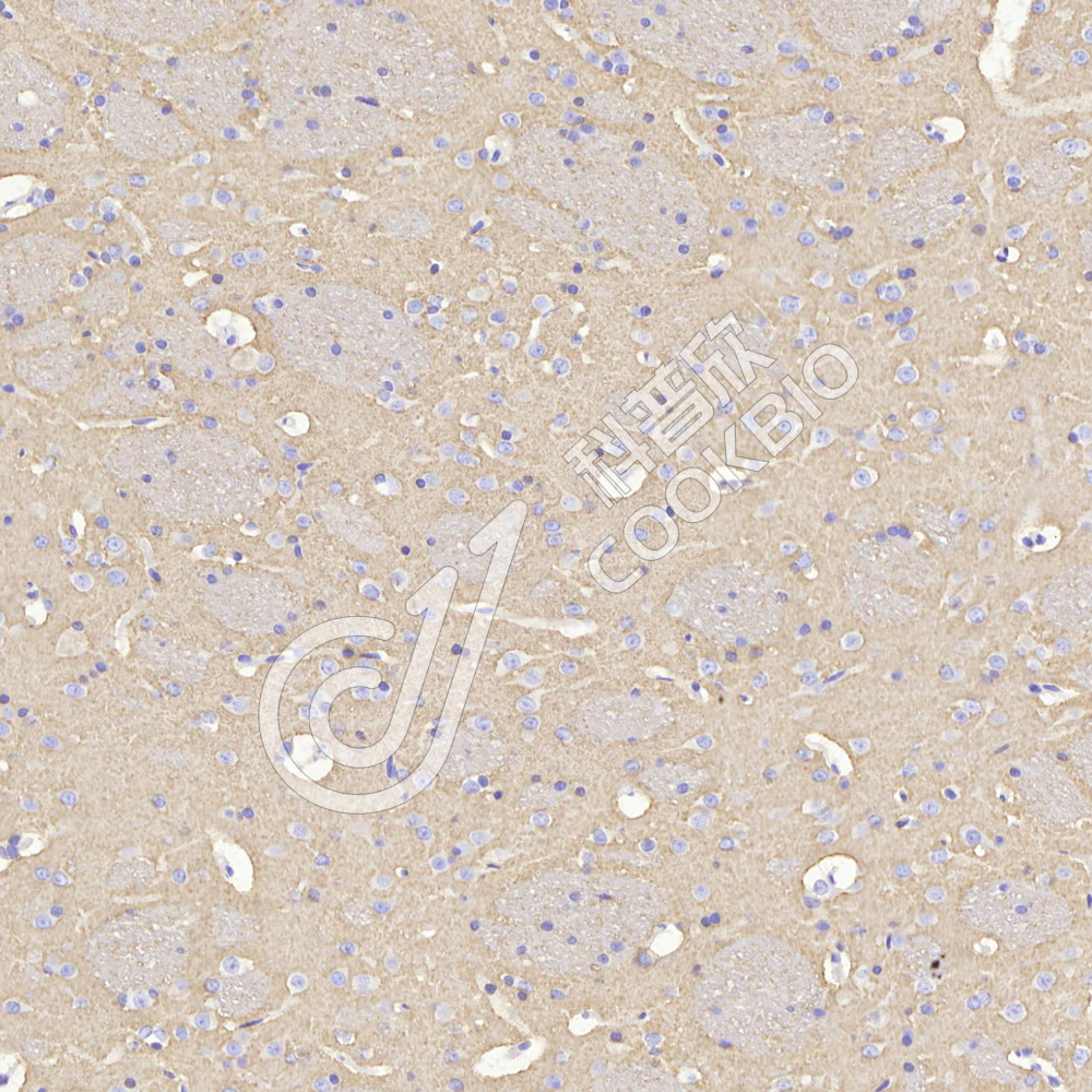 2 K133285_GAP43_9160511202_d600_R brain_20x_IHC.jpg