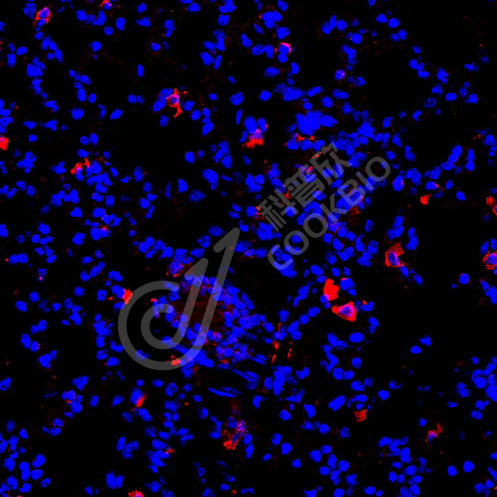 2 K133798_TLR9_red_34117011806_d300_M lung injury_40.0x_IF.jpg