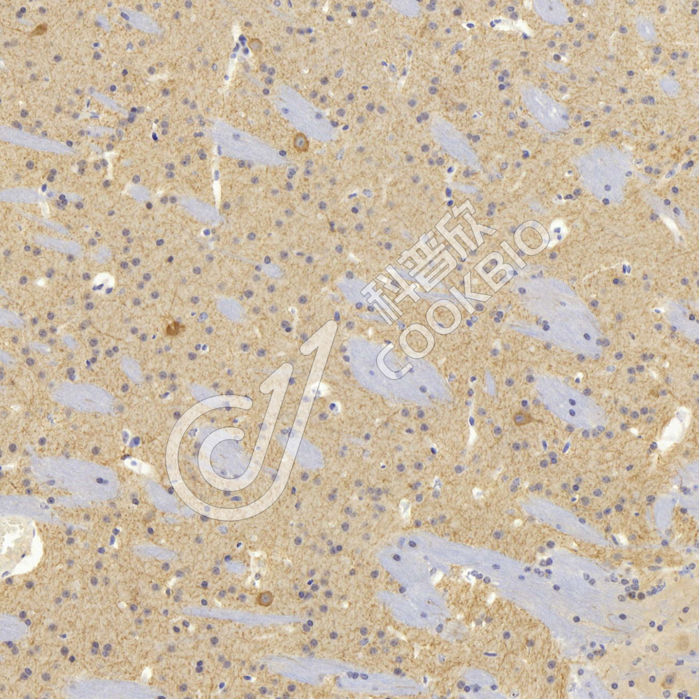 1 K133114-1_ACHE_26417011102_d1200_M brain_20.0x_IHC.jpg