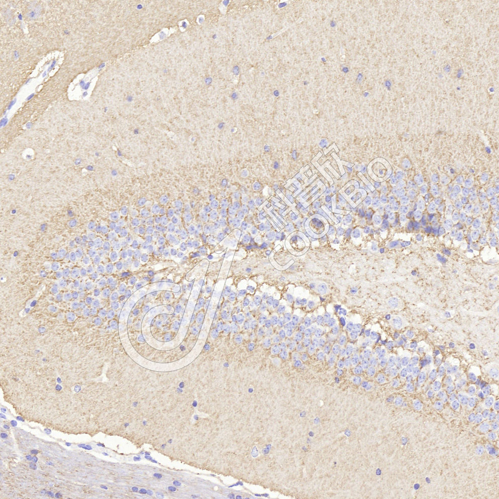 1 K133285_GAP43_9160511202_d600_M brain_24.5x_IHC.jpg