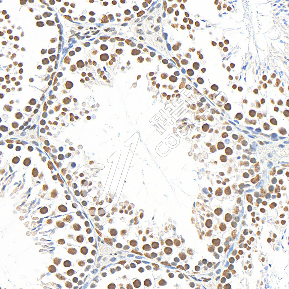 4 K133015_P38_S98023051605_d1500_M testis_40x_IHC.jpg