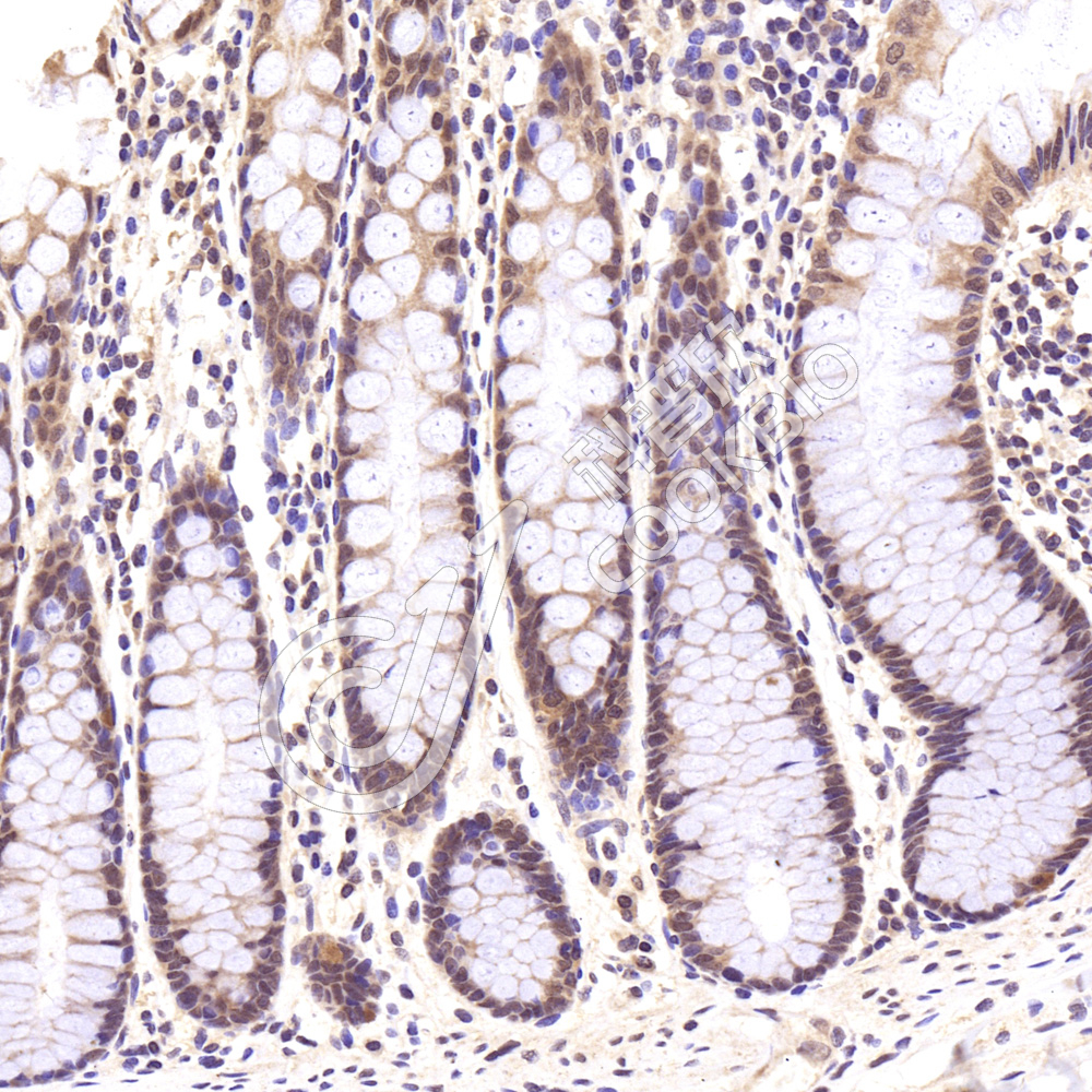 1 K133015_P38_15716101402_d1500_H colon_30.0x_IHC.jpg