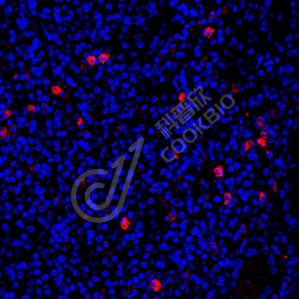 1 K133798_TLR9_red_34117011806_d300_H Lymphoma_40.0x_IF.jpg