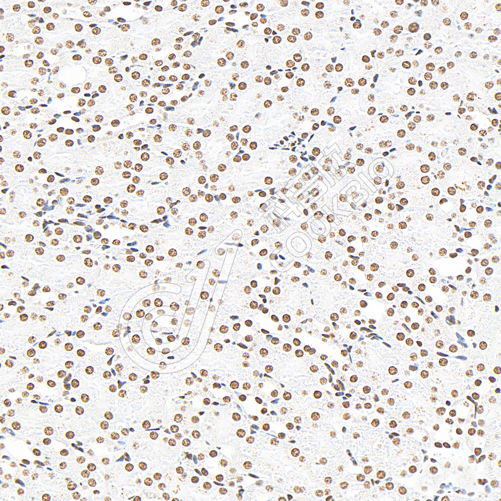 3 K133015_P38_S98023051605_d1500_M kidney_32.7x_IHC.jpg