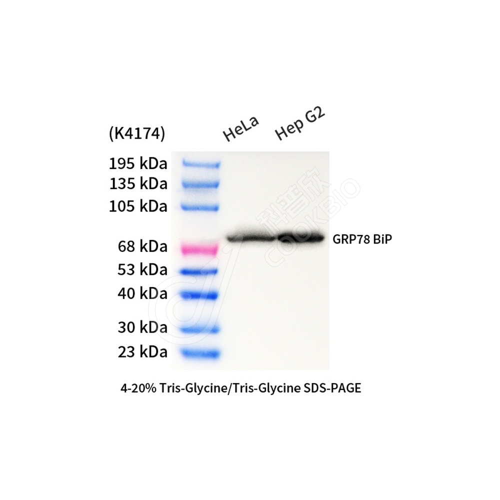 GRP78 BiP_d1000_WB
