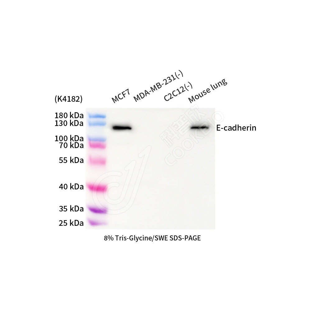 E-cadherin_d1000_WB