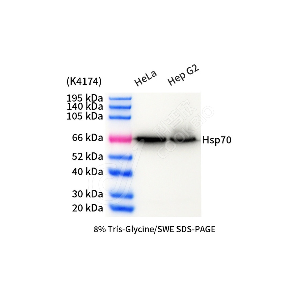 Hsp70_d1000_WB