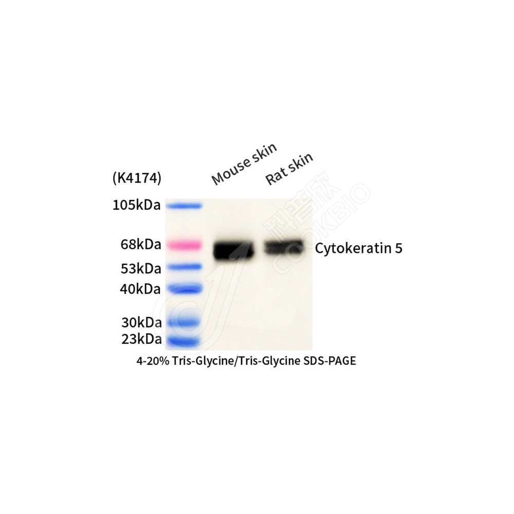 Cytokeratin 5_d1000_WB