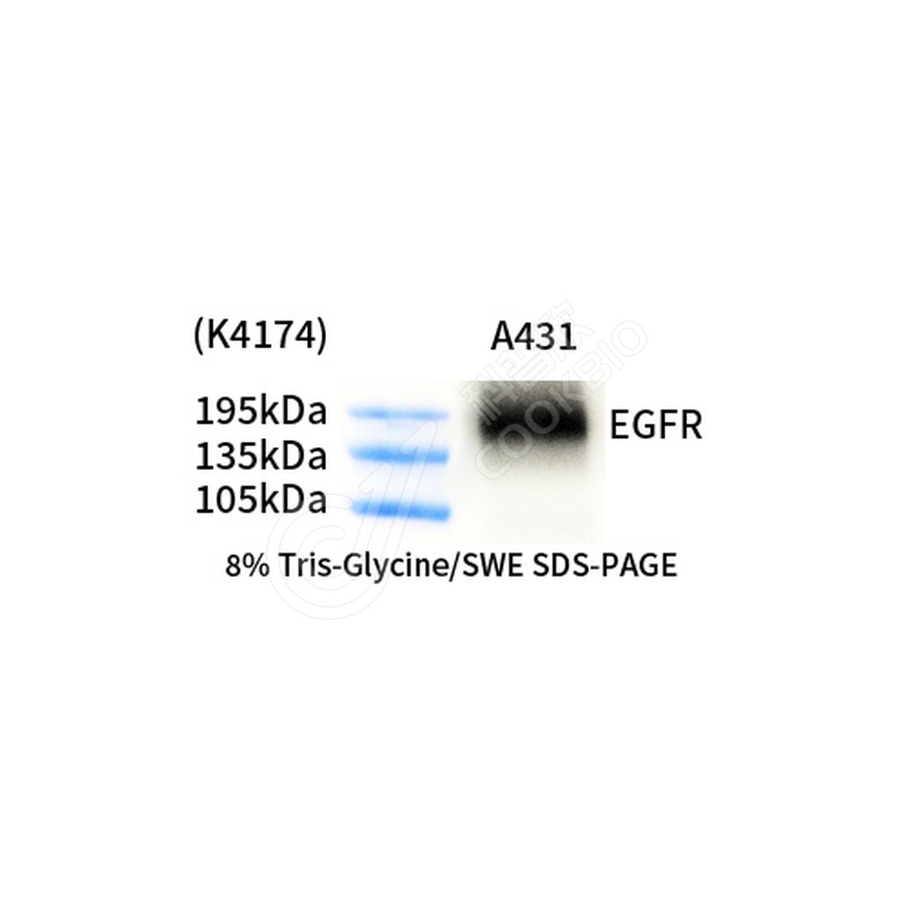 EGFR_d1000_WB