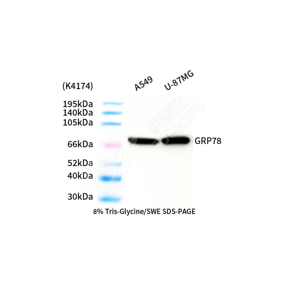 GRP78 BiP_d1000_WB