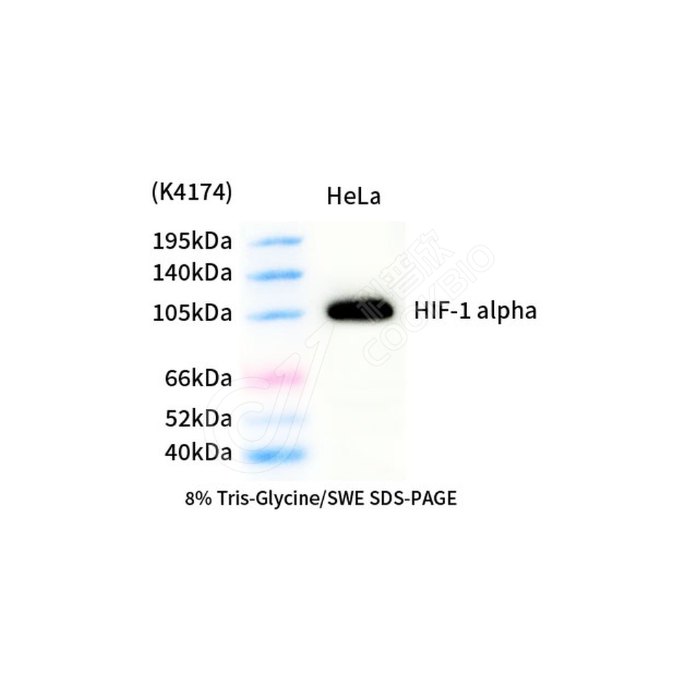 HIF-1 alpha_d1000_WB