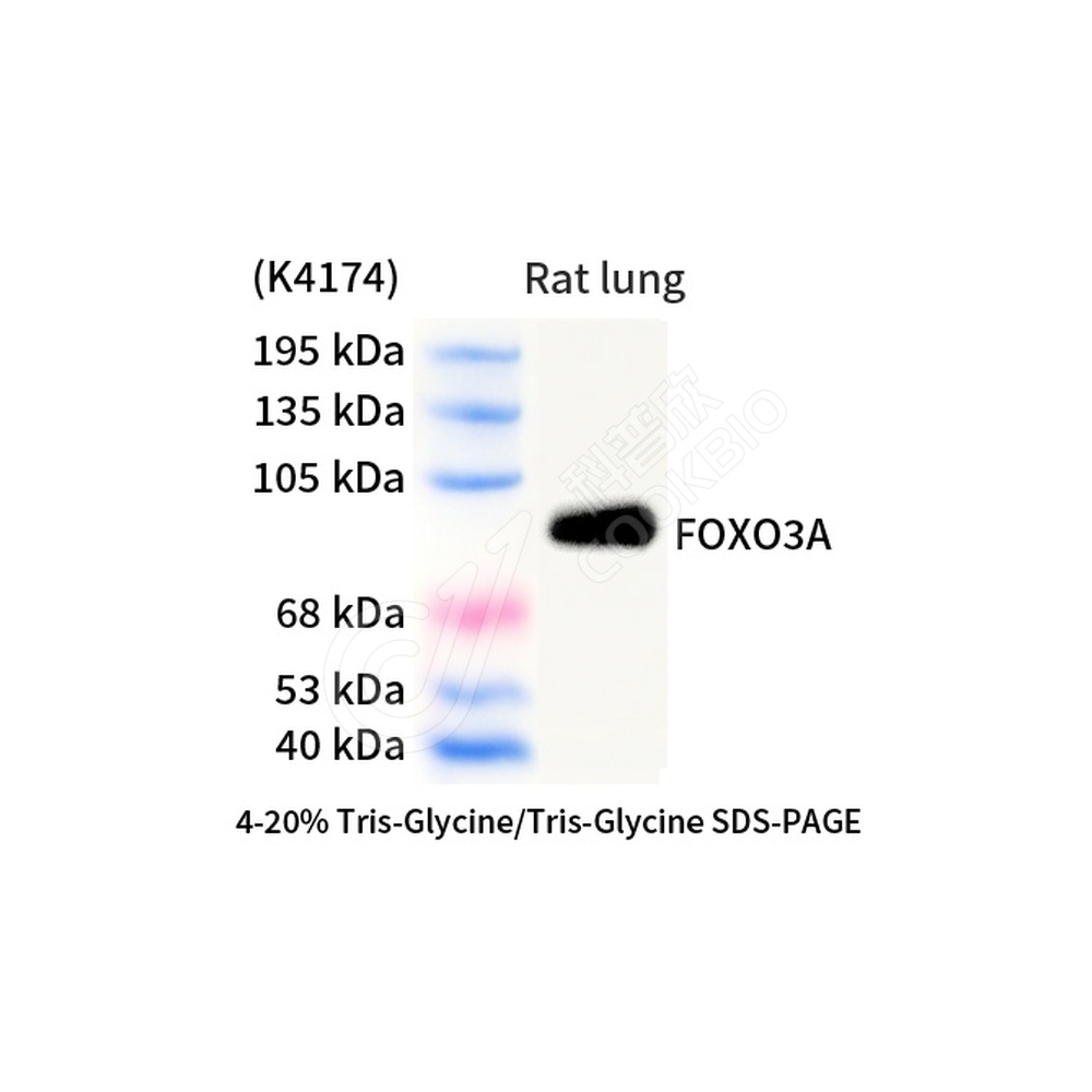 FOXO3A_d1000_WB
