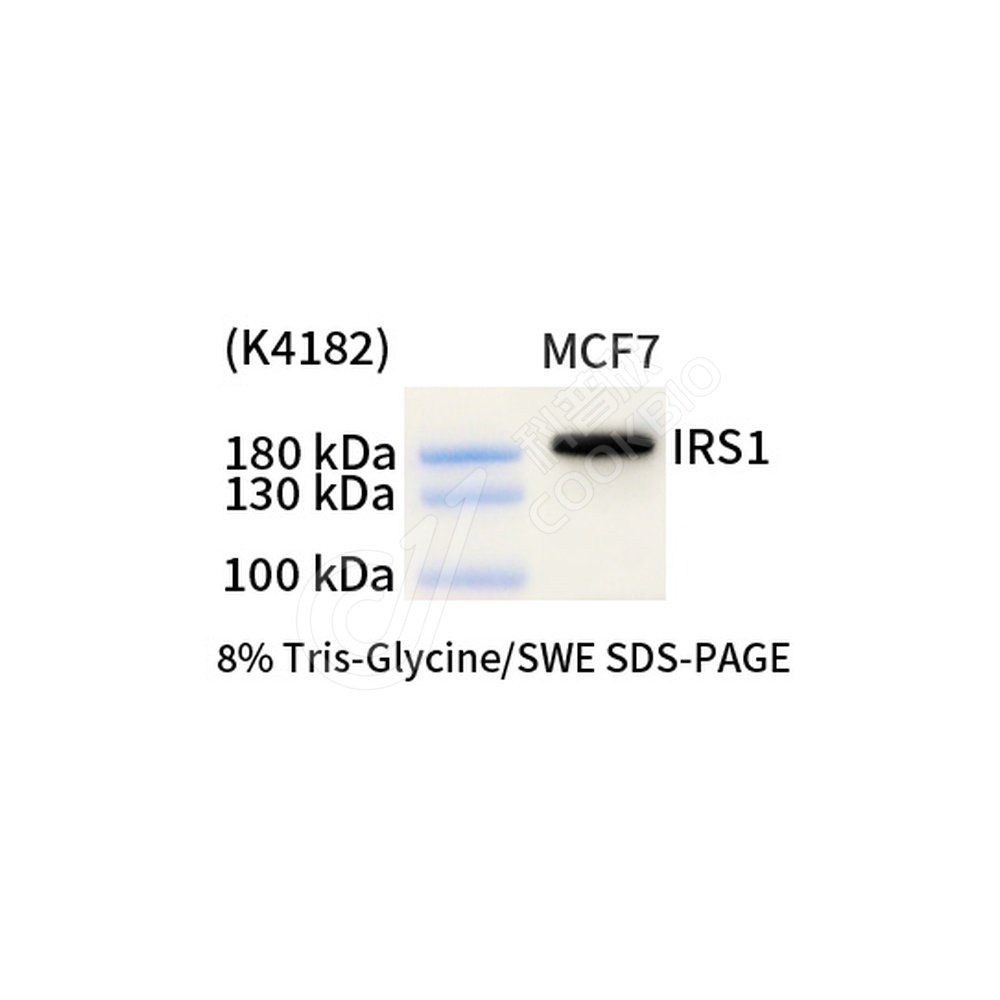 IRS1_d1000_WB
