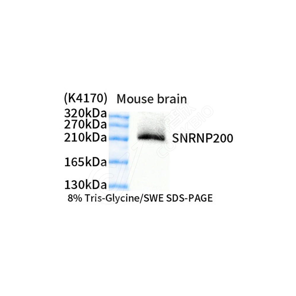 SNRNP200_d1000_WB