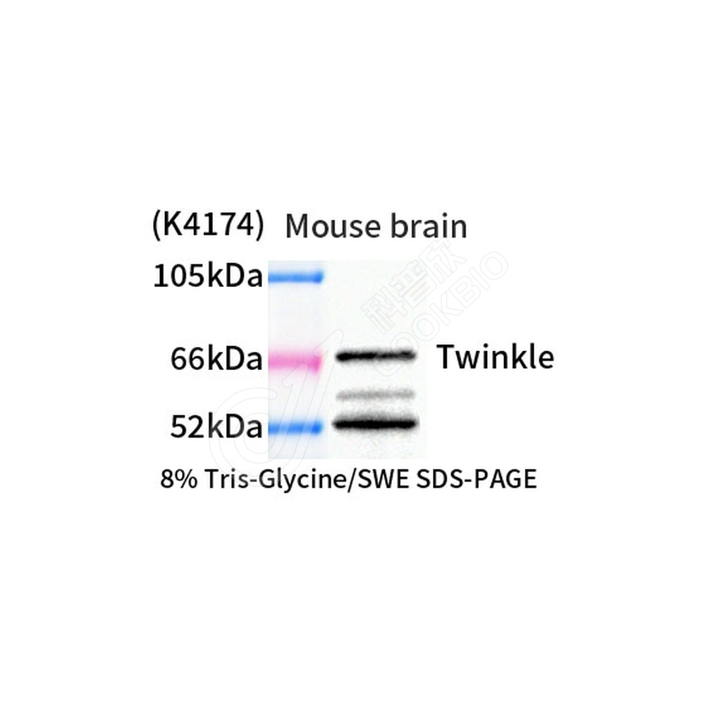 Twinkle_WB