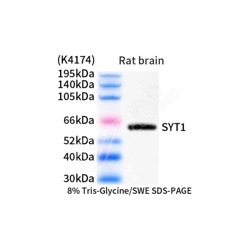 SYT1_d1000_WB