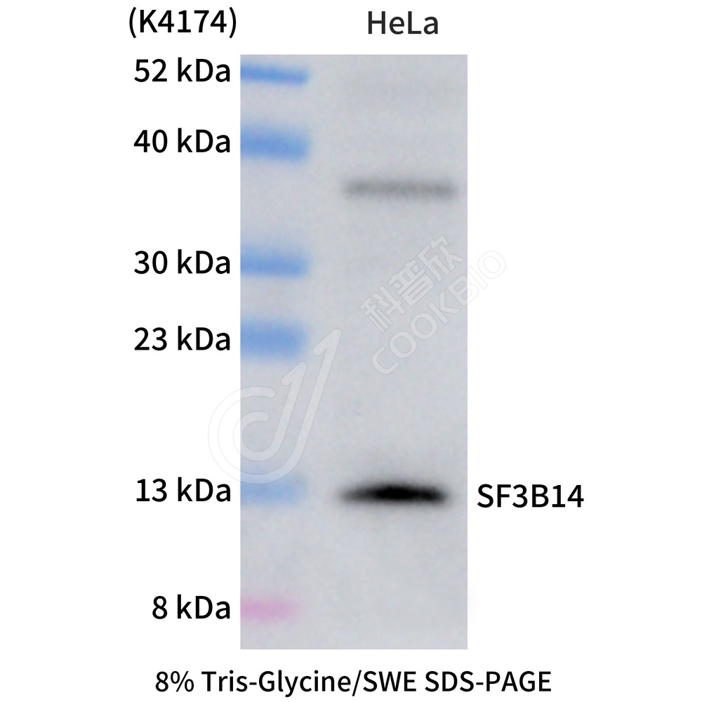 SF3B14_WB