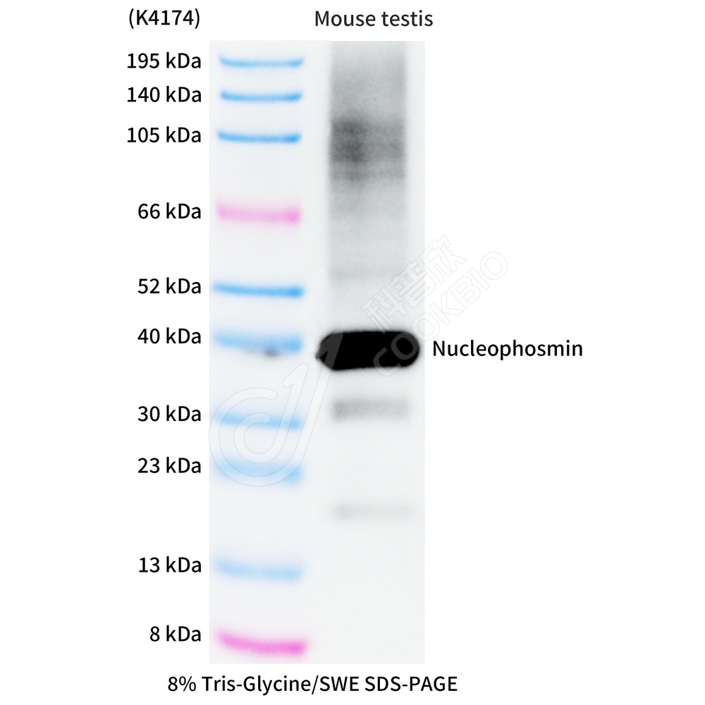 Nucleophosmin_WB