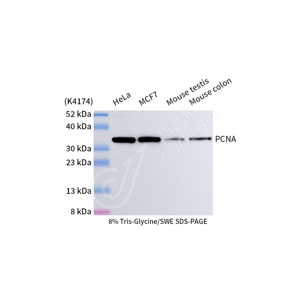 PCNA_WB