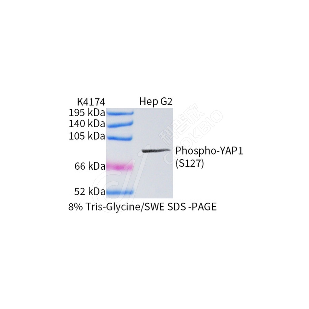 Phospho-YAP1 (S127)_WB