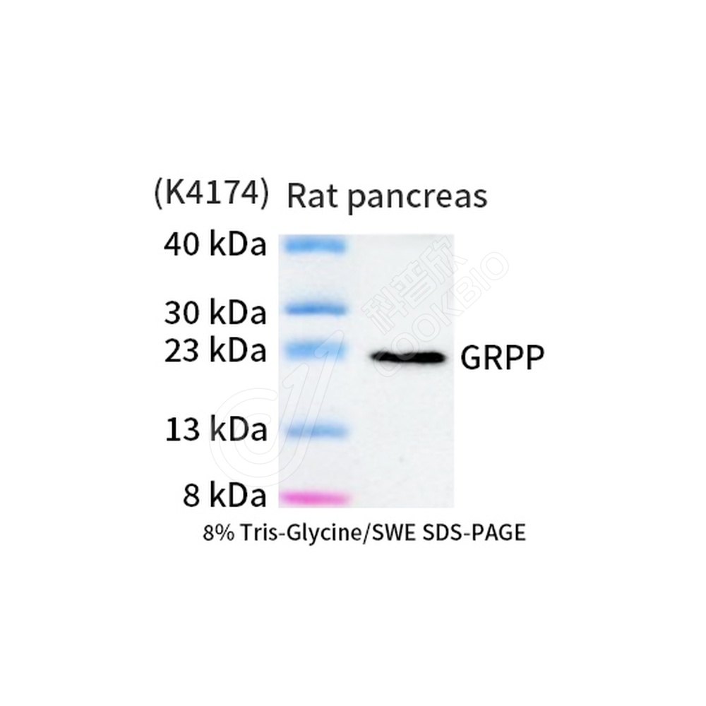 pro-glucagon_WB