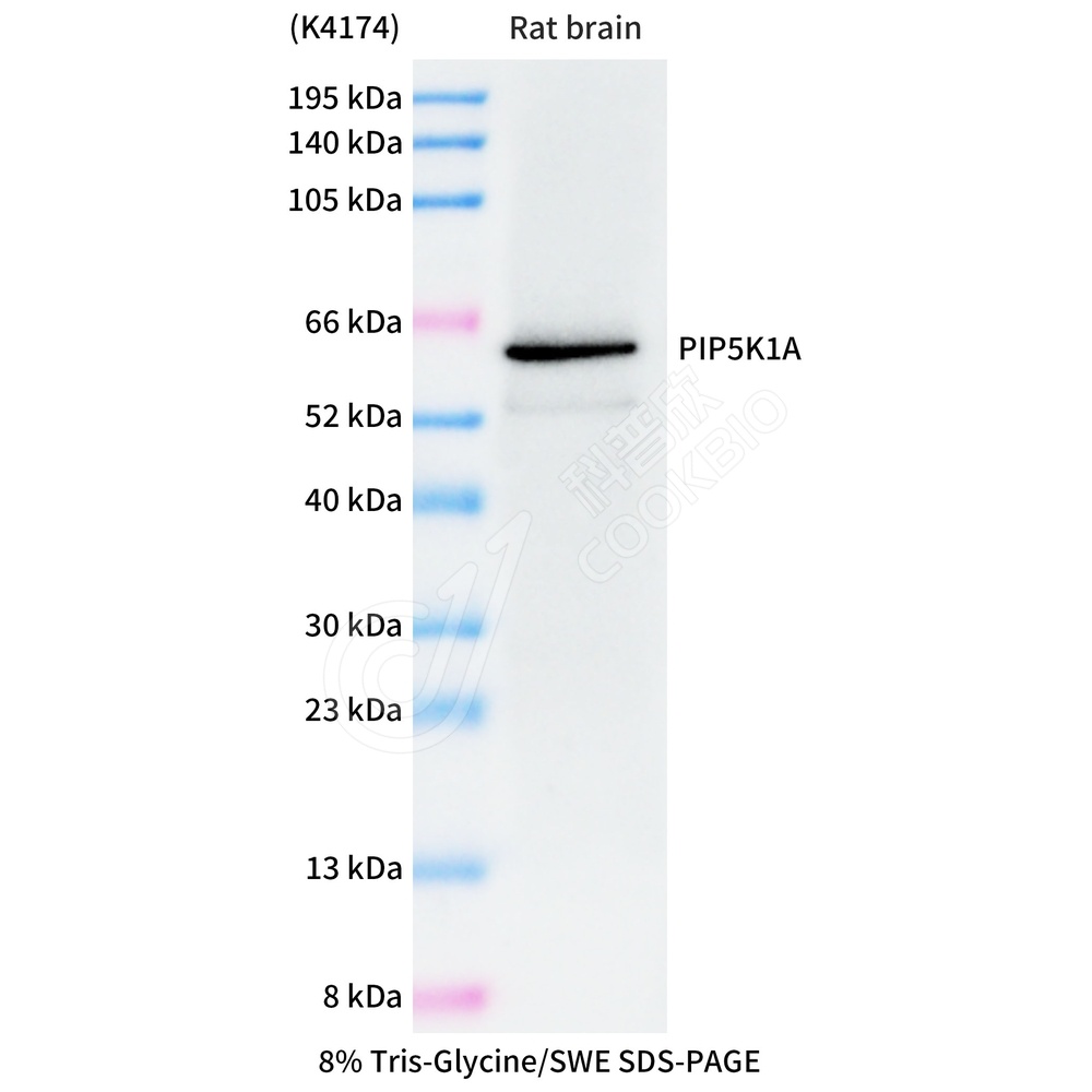 PIP5K1A_WB