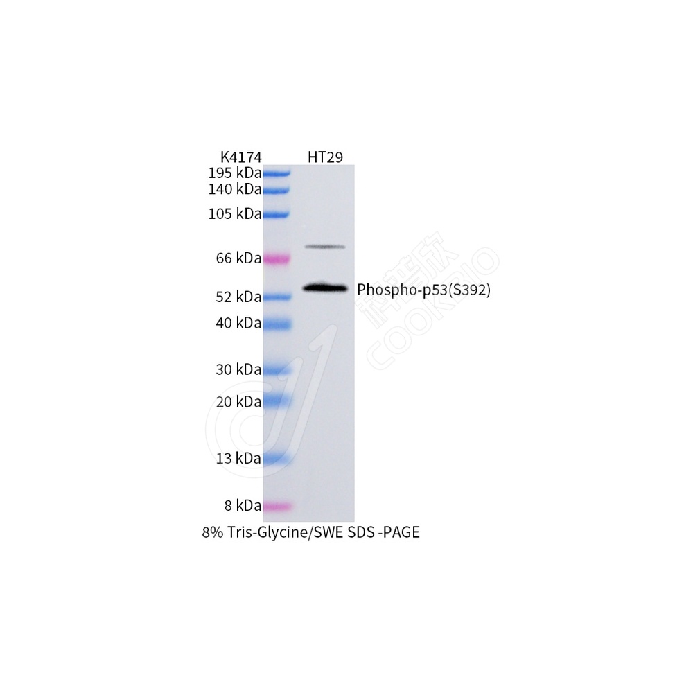 Phospho-p53 (S392)_WB
