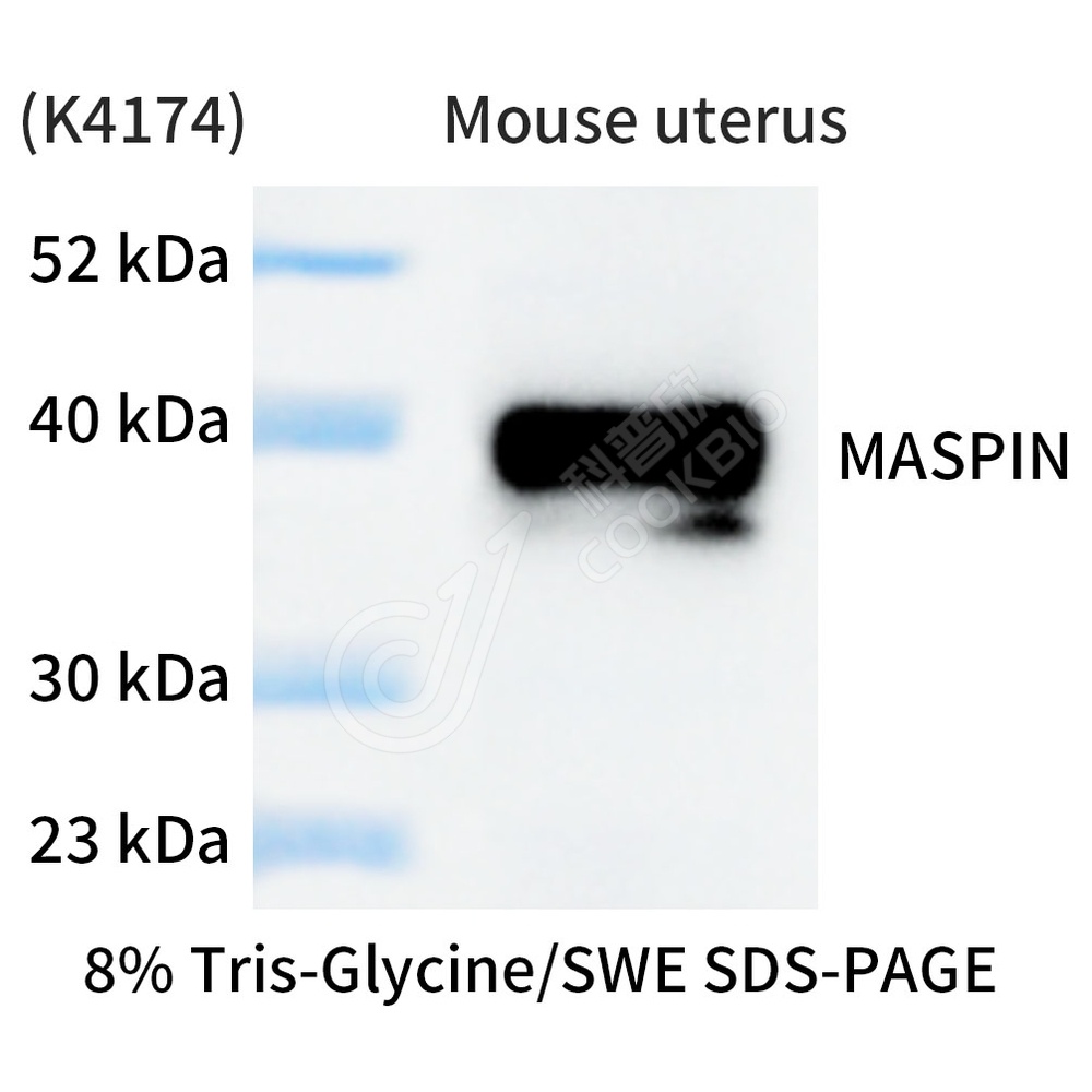 MASPIN_WB