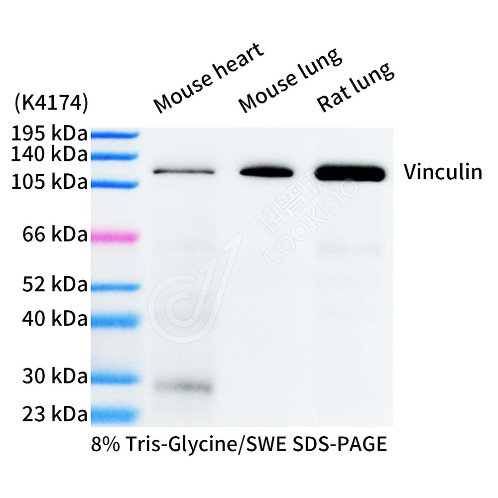 Vinculin_WB