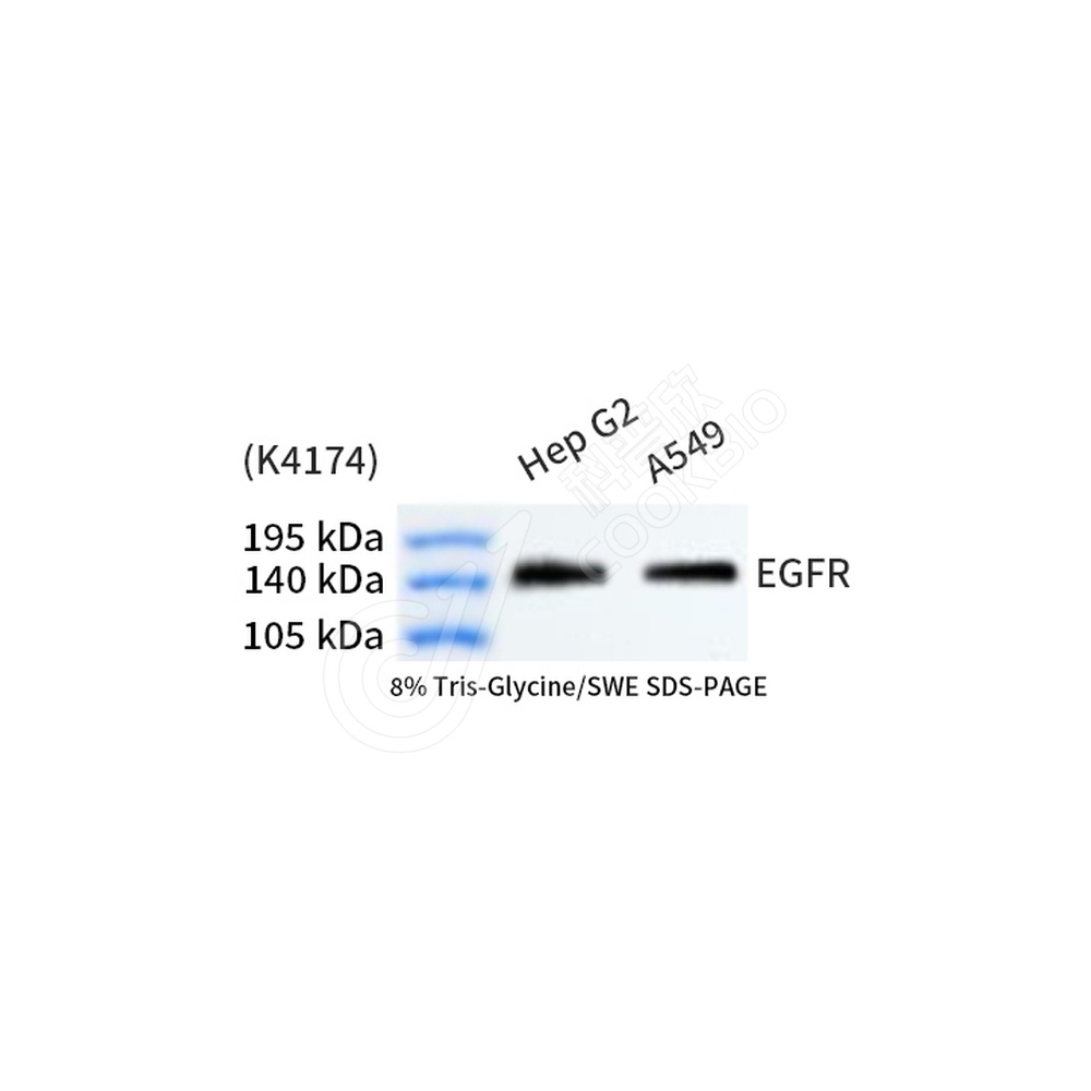 EGFR_WB