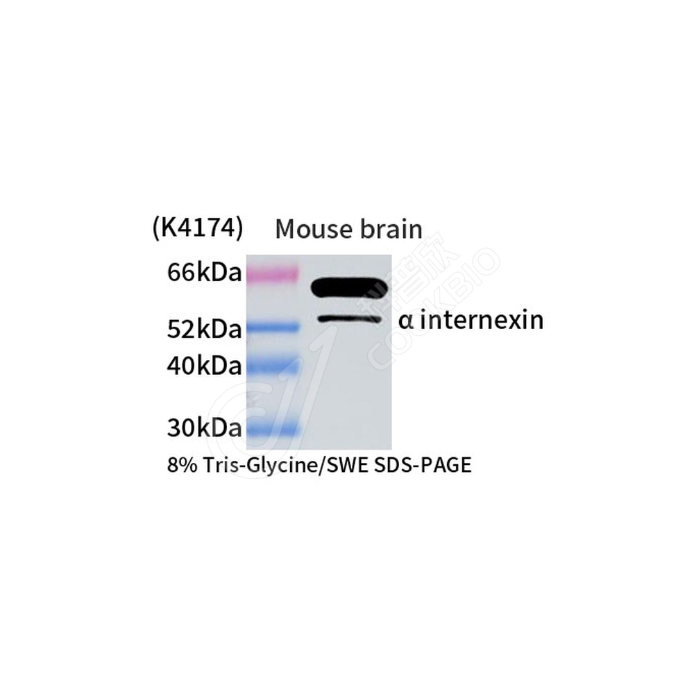Internexin_d1000_WB
