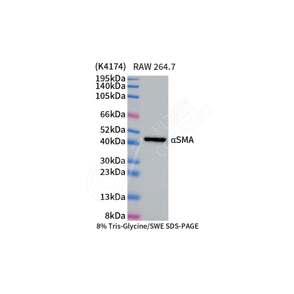 alpha smooth muscle Actin_d1000_WB