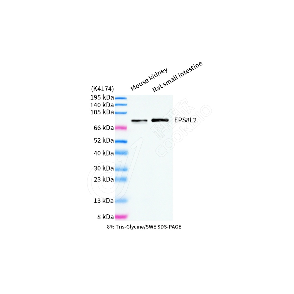 EPS8L2_WB