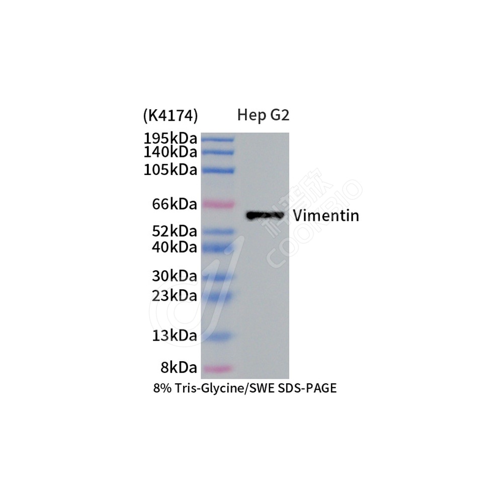 Vimentin_d1000 WB-2