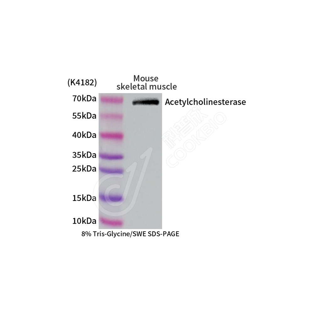 Acetylcholinesterase_d1000_WB