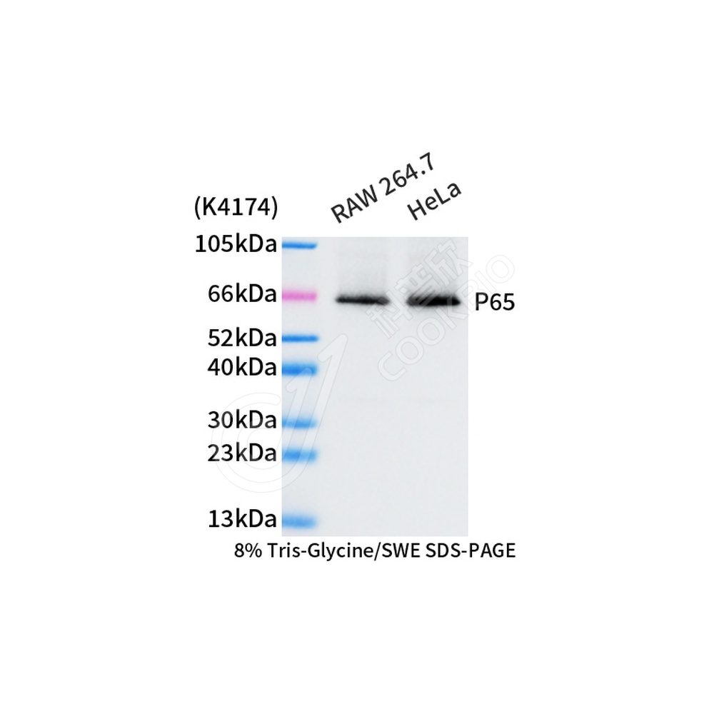 NF-κB p65_d1000_WB