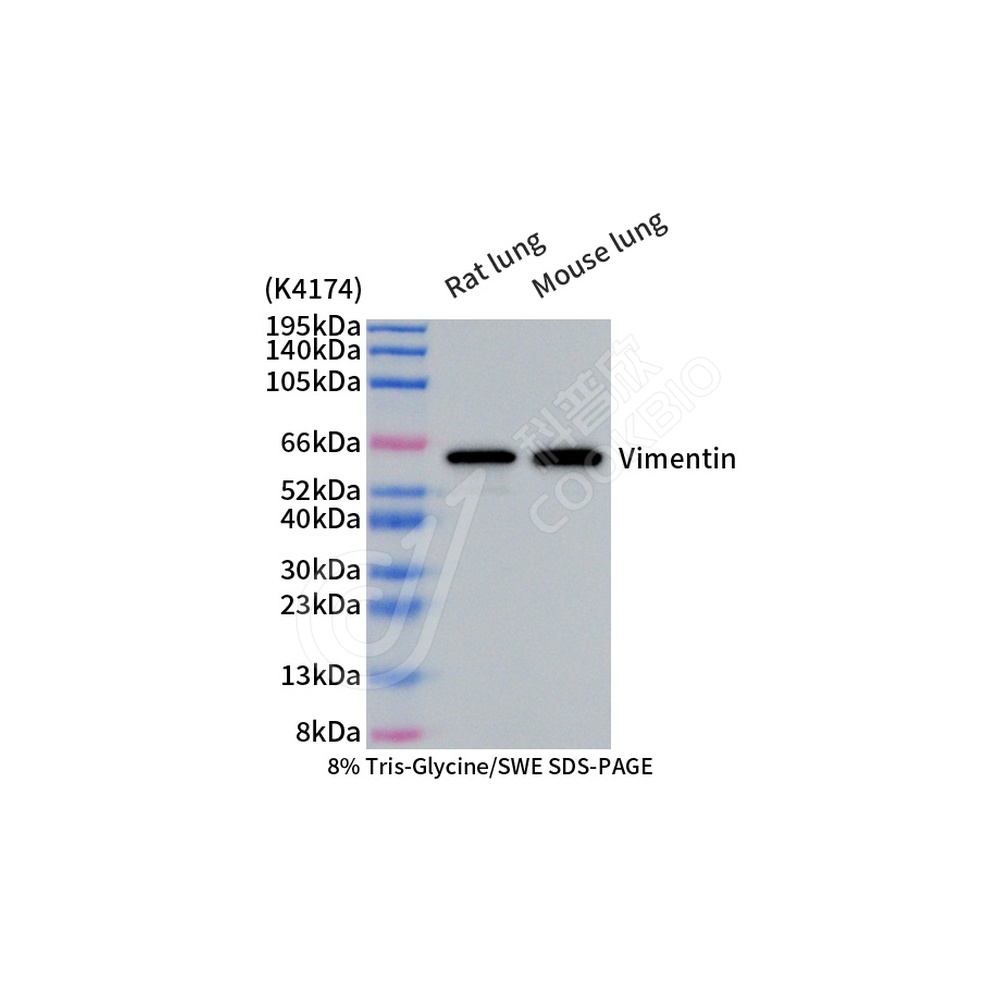 Vimentin_d1000 WB-1