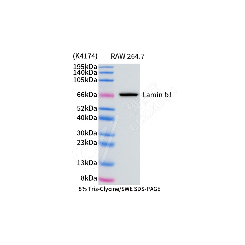 Lamin B1_d1000_WB