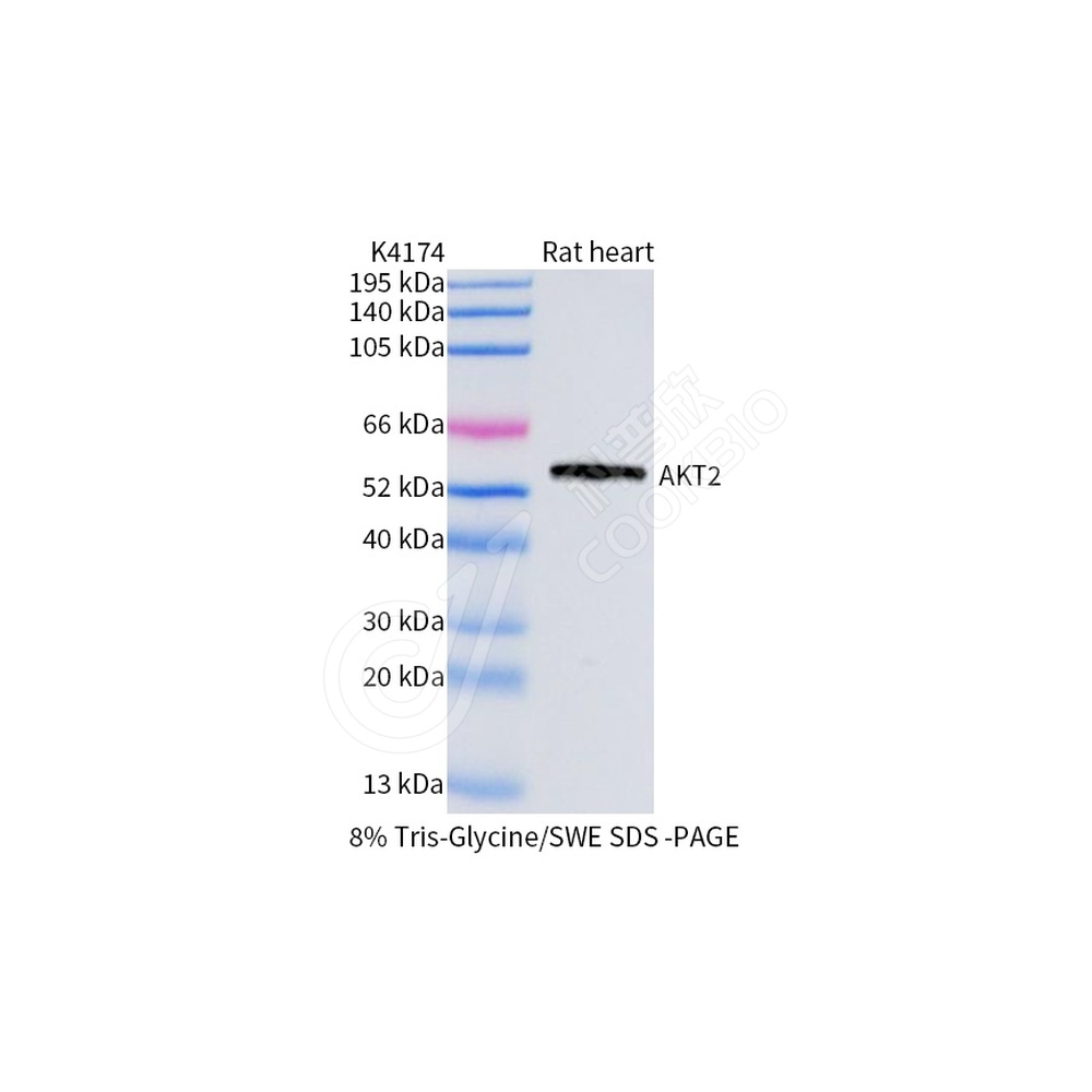 AKT2_WB