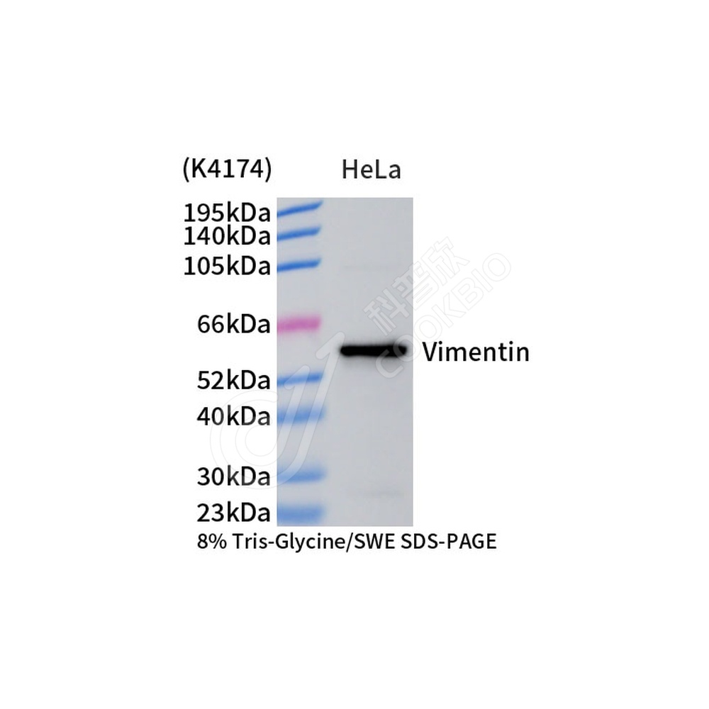 Vimentin_d1000_WB