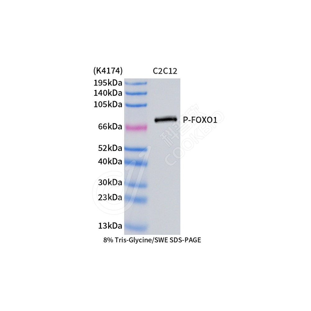 Phospho-FOXO1(S256)_d500_WB